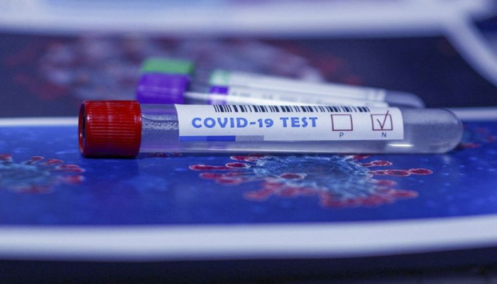 Azərbaycanda ümumilikdə 432 858 koronavirus testi aparılıb