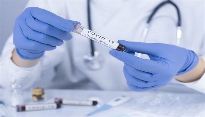 “25-26 iyulda koronavirus testlərinin cavabları səhv göndərilib” - RƏSMİ