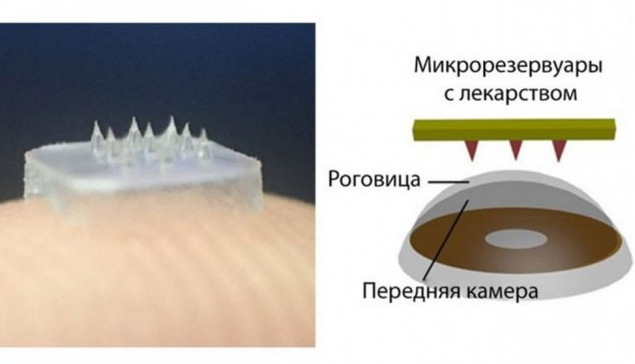 Китайские ученые изобрели контактные линзы с шипами