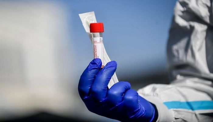 Koronavirus testlərinin səhv nəticə verməsinin səbəbi açıqlandı