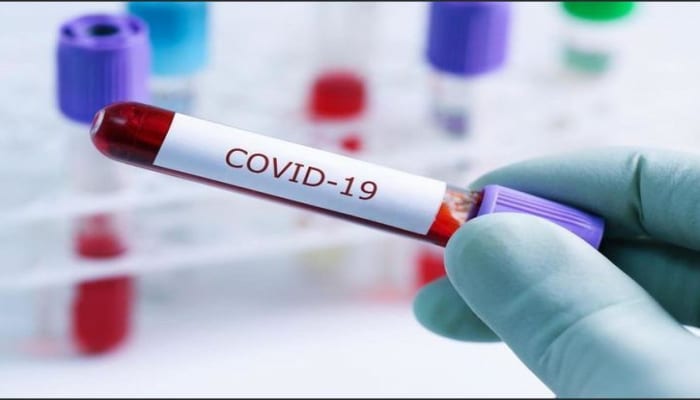 В Азербайджане еще у 15 человек обнаружен коронавирус