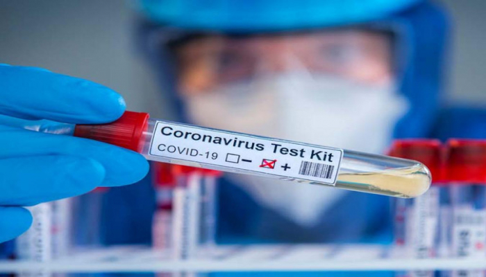 Azərbaycanda indiyədək aparılmış koronavirus testinin sayı açıqlandı