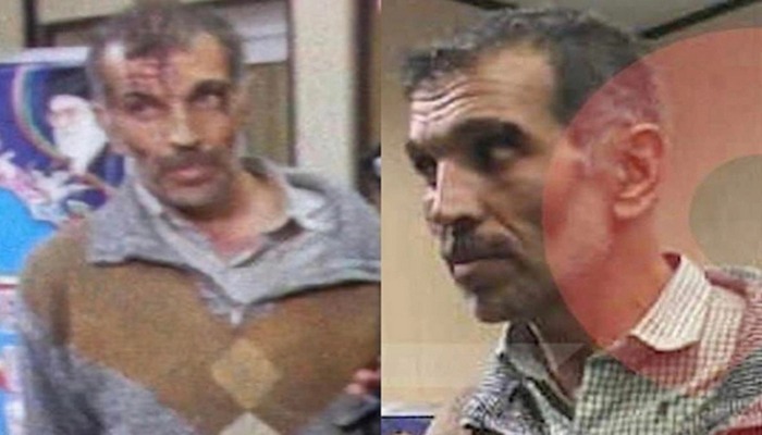 Azərbaycanın Tehrandakı səfirliyinə hücum edən şəxs EDAM OLUNDU