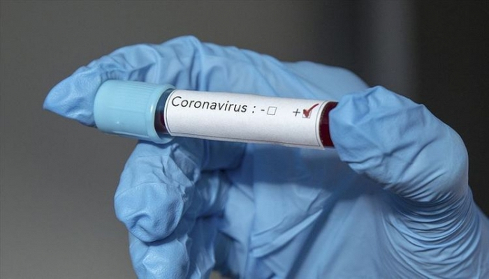 Azərbaycanda daha bir kənddə koronavirus yayıldı