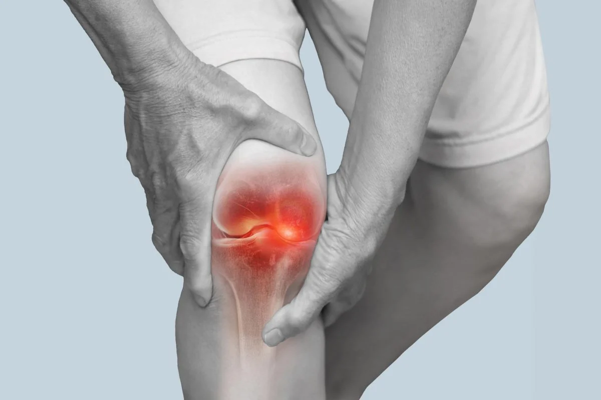 Diz osteoartriti qaçılmaz deyil: Sadə vərdişlər xəstəlik riskini azalda bilər