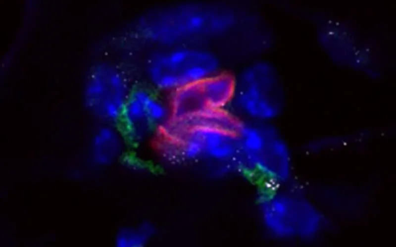 İltihab sümükdə “yatan” xərçəng hüceyrələrini yenidən aktivləşdirə bilər