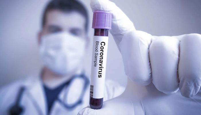 В России за сутки от коронавируса умерли 116 человек